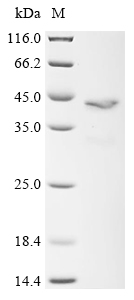 (Tris-Glycine gel) Discontinuous SDS-PAGE (reduced) with 5% enrichment gel and 15% separation gel.