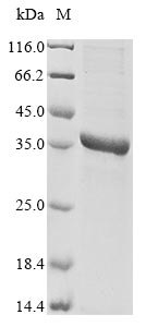 (Tris-Glycine gel) Discontinuous SDS-PAGE (reduced) with 5% enrichment gel and 15% separation gel. (Tris-Glycine gel) Discontinuous SDS-PAGE (reduced) with 5% enrichment gel and 15% separation gel.