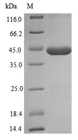 (Tris-Glycine gel) Discontinuous SDS-PAGE (reduced) with 5% enrichment gel and 15% separation gel. (Tris-Glycine gel) Discontinuous SDS-PAGE (reduced) with 5% enrichment gel and 15% separation gel.