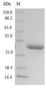 SDS-PAGE- Recombinant protein Mannheimia lktA
