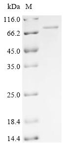 Recombinant Murid herpesvirus 1 Envelope glycoprotein L (gL) , Biotinylated - image 1