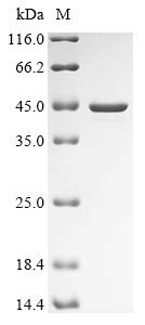 (Tris-Glycine gel) Discontinuous SDS-PAGE (reduced) with 5% enrichment gel and 15% separation gel. (Tris-Glycine gel) Discontinuous SDS-PAGE (reduced) with 5% enrichment gel and 15% separation gel.