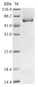 (Tris-Glycine gel) Discontinuous SDS-PAGE (reduced) with 5% enrichment gel and 15% separation gel. (Tris-Glycine gel) Discontinuous SDS-PAGE (reduced) with 5% enrichment gel and 15% separation gel.
