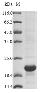 (Tris-Glycine gel) Discontinuous SDS-PAGE (reduced) with 5% enrichment gel and 15% separation gel. (Tris-Glycine gel) Discontinuous SDS-PAGE (reduced) with 5% enrichment gel and 15% separation gel.