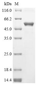 (Tris-Glycine gel) Discontinuous SDS-PAGE (reduced) with 5% enrichment gel and 15% separation gel. (Tris-Glycine gel) Discontinuous SDS-PAGE (reduced) with 5% enrichment gel and 15% separation gel.