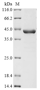 Recombinant Leishmania chagasi Guanine nucleotide-binding protein subunit beta-like protein - image 1