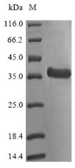 (Tris-Glycine gel) Discontinuous SDS-PAGE (reduced) with 5% enrichment gel and 15% separation gel.