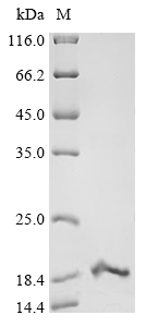 Recombinant Paraphysa scrofa Kappa-theraphotoxin-Ps1b - image 1