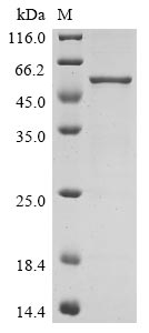 Recombinant Bovine coronavirus Nucleoprotein (N) - image 1
