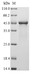 (Tris-Glycine gel) Discontinuous SDS-PAGE (reduced) with 5% enrichment gel and 15% separation gel.