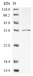 (Tris-Glycine gel) Discontinuous SDS-PAGE (reduced) with 5% enrichment gel and 15% separation gel.
