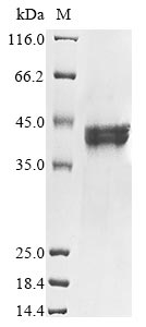 (Tris-Glycine gel) Discontinuous SDS-PAGE (reduced) with 5% enrichment gel and 15% separation gel.