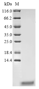 (Tris-Glycine gel) Discontinuous SDS-PAGE (reduced) with 5% enrichment gel and 15% separation gel. (Tris-Glycine gel) Discontinuous SDS-PAGE (reduced) with 5% enrichment gel and 15% separation gel.