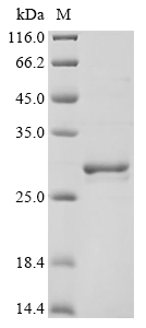 (Tris-Glycine gel) Discontinuous SDS-PAGE (reduced) with 5% enrichment gel and 15% separation gel. (Tris-Glycine gel) Discontinuous SDS-PAGE (reduced) with 5% enrichment gel and 15% separation gel.