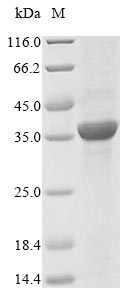 SDS-PAGE- Recombinant protein Escherichia mrcB