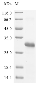 Recombinant JC polyomavirus Small t antigen - image 1
