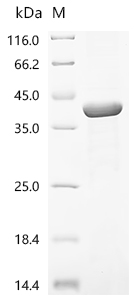 Recombinant Epstein-Barr virus Envelope glycoprotein L (gL) - image 1