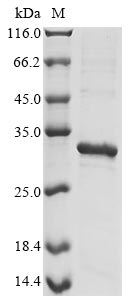 Recombinant Epstein-Barr virus Secreted protein BARF1 (BARF1) - image 1