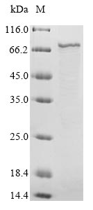 (Tris-Glycine gel) Discontinuous SDS-PAGE (reduced) with 5% enrichment gel and 15% separation gel. (Tris-Glycine gel) Discontinuous SDS-PAGE (reduced) with 5% enrichment gel and 15% separation gel.