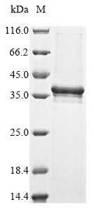 (Tris-Glycine gel) Discontinuous SDS-PAGE (reduced) with 5% enrichment gel and 15% separation gel. (Tris-Glycine gel) Discontinuous SDS-PAGE (reduced) with 5% enrichment gel and 15% separation gel.