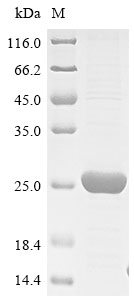 (Tris-Glycine gel) Discontinuous SDS-PAGE (reduced) with 5% enrichment gel and 15% separation gel. (Tris-Glycine gel) Discontinuous SDS-PAGE (reduced) with 5% enrichment gel and 15% separation gel.