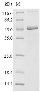 (Tris-Glycine gel) Discontinuous SDS-PAGE (reduced) with 5% enrichment gel and 15% separation gel. (Tris-Glycine gel) Discontinuous SDS-PAGE (reduced) with 5% enrichment gel and 15% separation gel.
