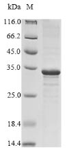 SDS-PAGE- Recombinant protein Vesicular M