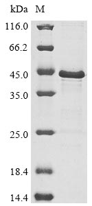 Recombinant Vesicular stomatitis Indiana virus Phosphoprotein (P) - image 1