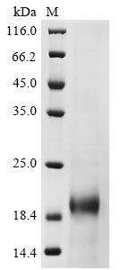 (Tris-Glycine gel) Discontinuous SDS-PAGE (reduced) with 5% enrichment gel and 15% separation gel. (Tris-Glycine gel) Discontinuous SDS-PAGE (reduced) with 5% enrichment gel and 15% separation gel.