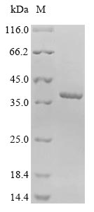 (Tris-Glycine gel) Discontinuous SDS-PAGE (reduced) with 5% enrichment gel and 15% separation gel. (Tris-Glycine gel) Discontinuous SDS-PAGE (reduced) with 5% enrichment gel and 15% separation gel.