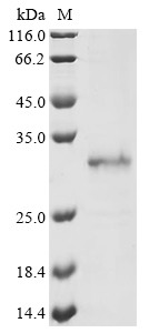 Recombinant Aequorea victoria Aequorin-1 - image 1