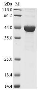 (Tris-Glycine gel) Discontinuous SDS-PAGE (reduced) with 5% enrichment gel and 15% separation gel.