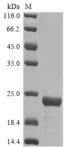 (Tris-Glycine gel) Discontinuous SDS-PAGE (reduced) with 5% enrichment gel and 15% separation gel. (Tris-Glycine gel) Discontinuous SDS-PAGE (reduced) with 5% enrichment gel and 15% separation gel.