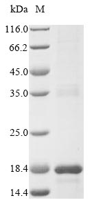 (Tris-Glycine gel) Discontinuous SDS-PAGE (reduced) with 5% enrichment gel and 15% separation gel. (Tris-Glycine gel) Discontinuous SDS-PAGE (reduced) with 5% enrichment gel and 15% separation gel.