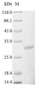(Tris-Glycine gel) Discontinuous SDS-PAGE (reduced) with 5% enrichment gel and 15% separation gel. (Tris-Glycine gel) Discontinuous SDS-PAGE (reduced) with 5% enrichment gel and 15% separation gel.