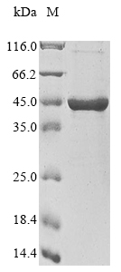 (Tris-Glycine gel) Discontinuous SDS-PAGE (reduced) with 5% enrichment gel and 15% separation gel. (Tris-Glycine gel) Discontinuous SDS-PAGE (reduced) with 5% enrichment gel and 15% separation gel.