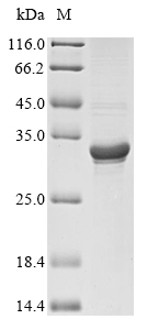 (Tris-Glycine gel) Discontinuous SDS-PAGE (reduced) with 5% enrichment gel and 15% separation gel.