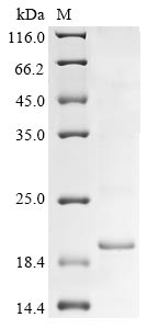 (Tris-Glycine gel) Discontinuous SDS-PAGE (reduced) with 5% enrichment gel and 15% separation gel. (Tris-Glycine gel) Discontinuous SDS-PAGE (reduced) with 5% enrichment gel and 15% separation gel.