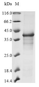 (Tris-Glycine gel) Discontinuous SDS-PAGE (reduced) with 5% enrichment gel and 15% separation gel. (Tris-Glycine gel) Discontinuous SDS-PAGE (reduced) with 5% enrichment gel and 15% separation gel.