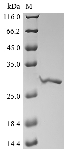 (Tris-Glycine gel) Discontinuous SDS-PAGE (reduced) with 5% enrichment gel and 15% separation gel.