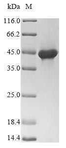 SDS-PAGE- Recombinant protein Lymphocytic GPC