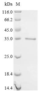 Recombinant Lymphocytic choriomeningitis virus Pre-glycoprotein polyprotein GP complex (GPC) , Partial - image 1