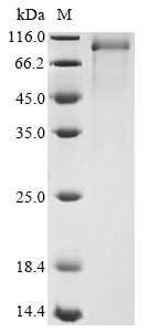 (Tris-Glycine gel) Discontinuous SDS-PAGE (reduced) with 5% enrichment gel and 15% separation gel. (Tris-Glycine gel) Discontinuous SDS-PAGE (reduced) with 5% enrichment gel and 15% separation gel.