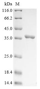 (Tris-Glycine gel) Discontinuous SDS-PAGE (reduced) with 5% enrichment gel and 15% separation gel. (Tris-Glycine gel) Discontinuous SDS-PAGE (reduced) with 5% enrichment gel and 15% separation gel.