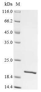 (Tris-Glycine gel) Discontinuous SDS-PAGE (reduced) with 5% enrichment gel and 15% separation gel. (Tris-Glycine gel) Discontinuous SDS-PAGE (reduced) with 5% enrichment gel and 15% separation gel.