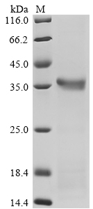 Recombinant Mouse Mannan-binding protein (Mbl2) - image 1