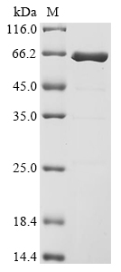 (Tris-Glycine gel) Discontinuous SDS-PAGE (reduced) with 5% enrichment gel and 15% separation gel. (Tris-Glycine gel) Discontinuous SDS-PAGE (reduced) with 5% enrichment gel and 15% separation gel.