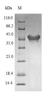 (Tris-Glycine gel) Discontinuous SDS-PAGE (reduced) with 5% enrichment gel and 15% separation gel.