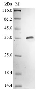 (Tris-Glycine gel) Discontinuous SDS-PAGE (reduced) with 5% enrichment gel and 15% separation gel.