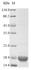(Tris-Glycine gel) Discontinuous SDS-PAGE (reduced) with 5% enrichment gel and 15% separation gel. (Tris-Glycine gel) Discontinuous SDS-PAGE (reduced) with 5% enrichment gel and 15% separation gel.